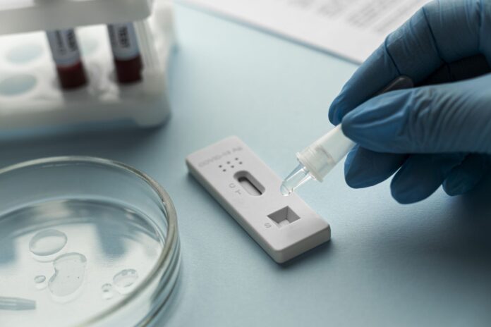 Test antygenowy na obecność koronawirusa